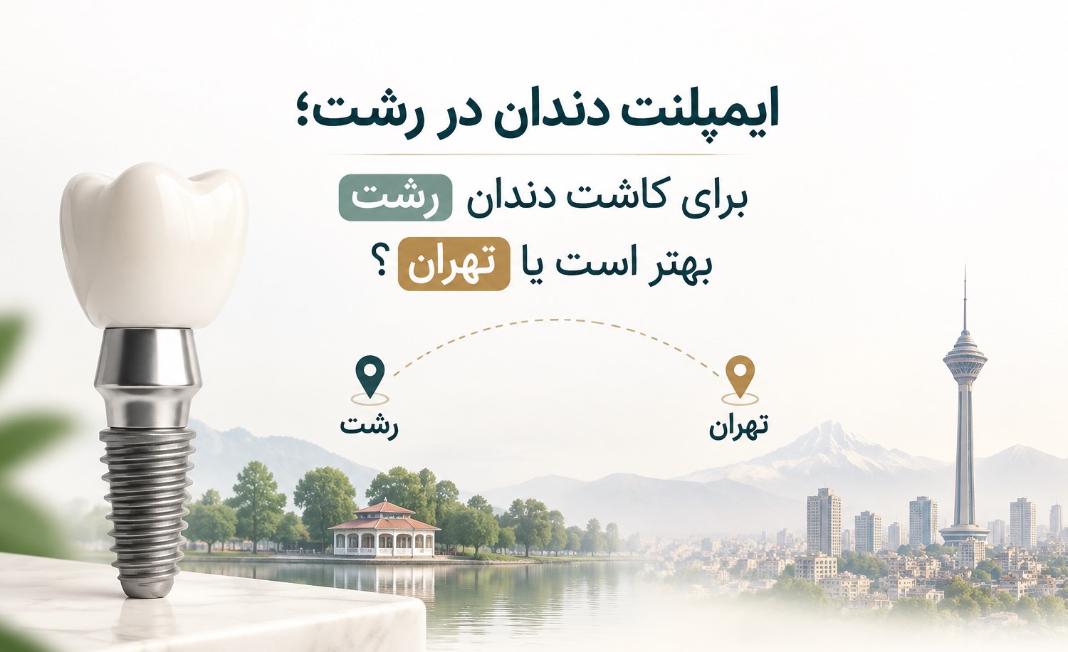 ایمپلنت دندان برای بیماران رشت و بررسی مراجعه به متخصص در تهران